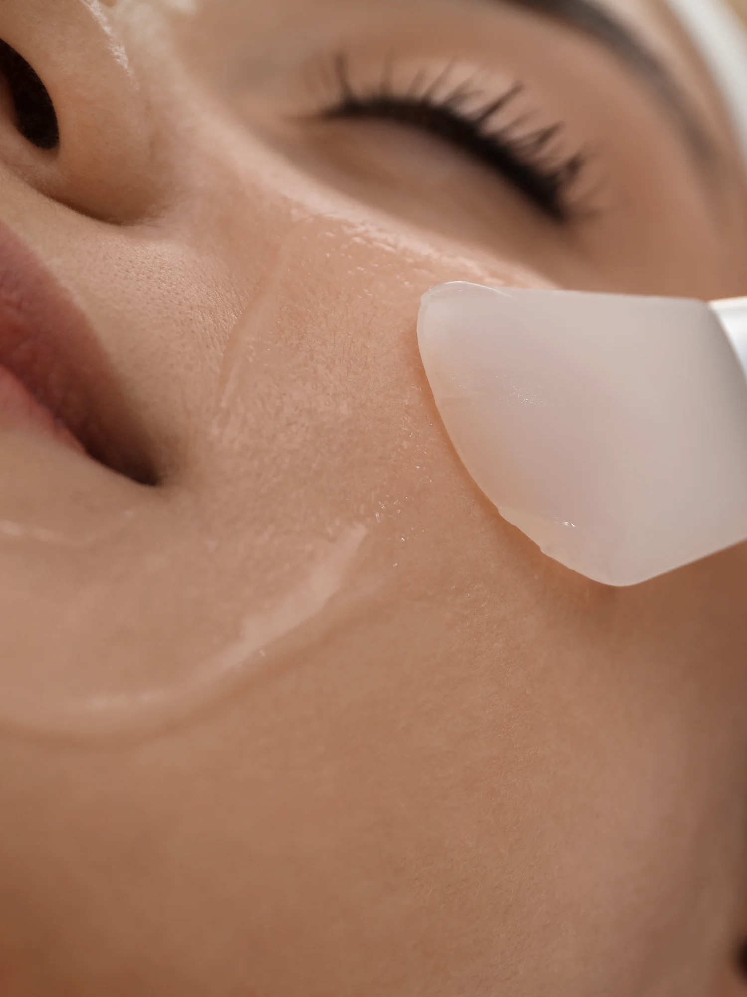 A skincare professional applying a facial peel treatment