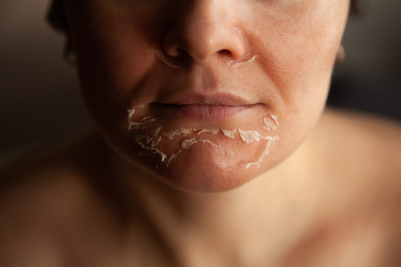 Professional Vivant enzyme peel treatment