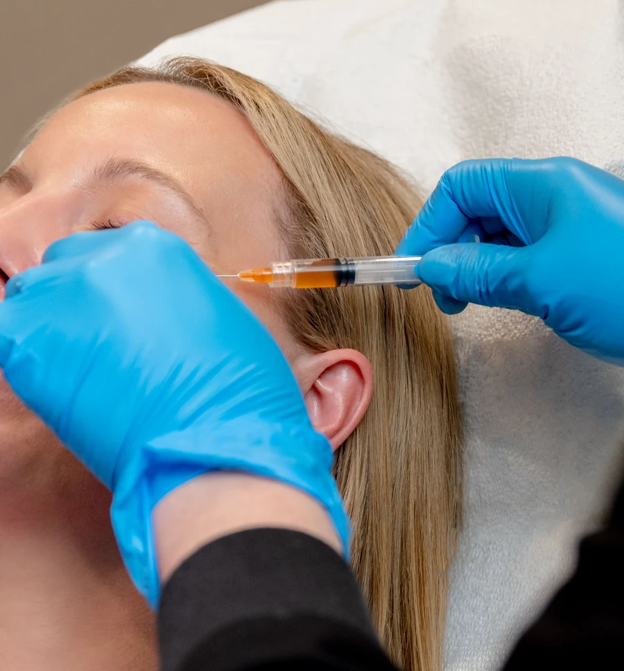 PRF Skin Rejuvenation treatment at Revolution MedSpa
